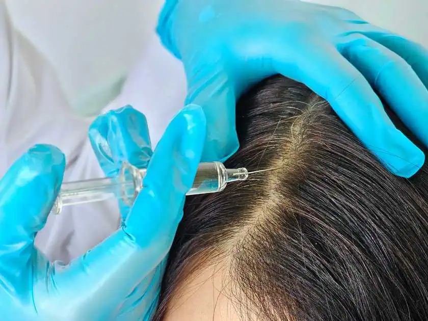 Hair Loss Treatment by SkinSplendid in New York, NY