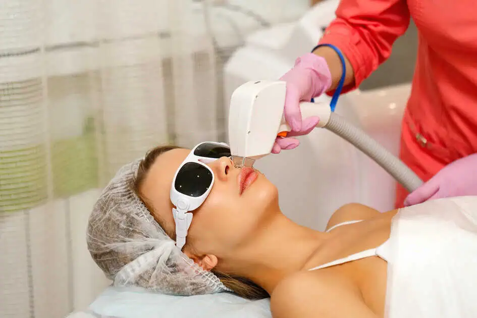 CoolPeel CO2 Laser by SkinSplendid in New York