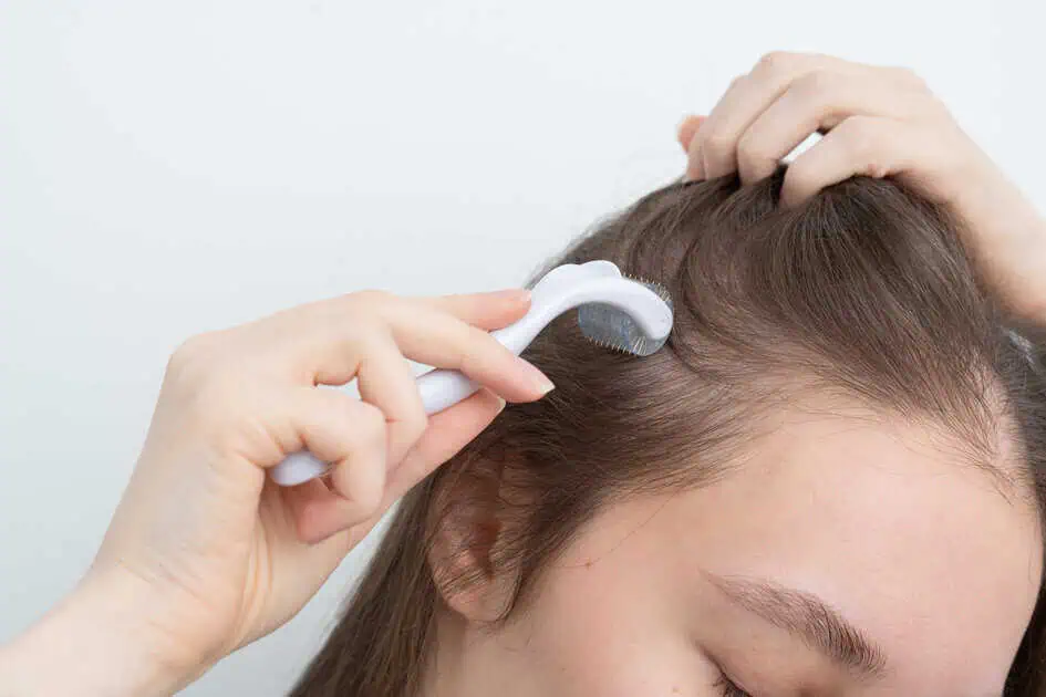 Hair Loss Treatments