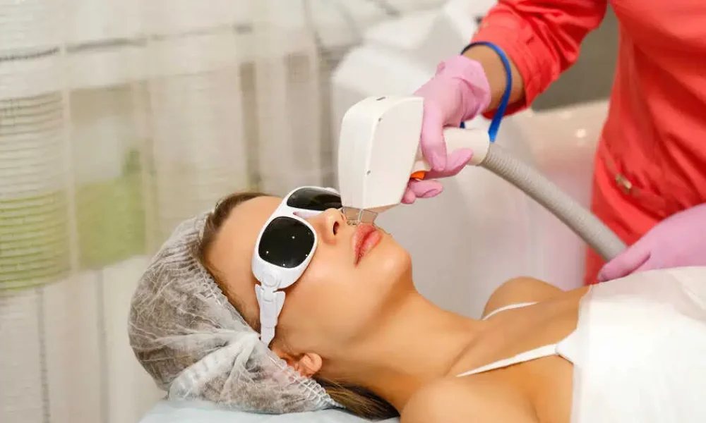 CoolPeel CO2 Laser by SkinSplendid in New York
