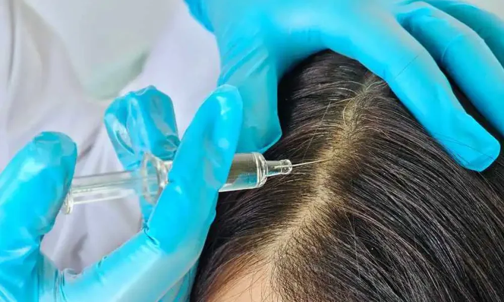 Hair Loss Treatment by SkinSplendid in New York, NY