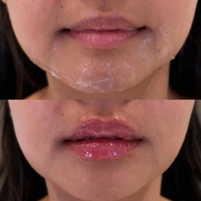 Signature Lip Filler (4)